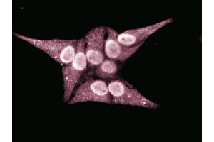 Immunofluorescent staining of HeLa cells.