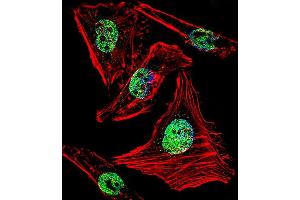 Fluorescent confocal image of Hela cell stained with ZBTB7B Antibody . (ZBTB7B anticorps  (C-Term))