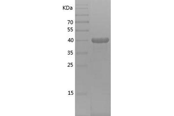 ARPC5L Protein (AA 1-153) (His-IF2DI Tag)