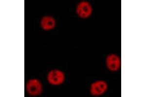 ABIN6274458 staining HepG2 cells by IF/ICC. (TAF15 anticorps  (Internal Region))