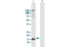 Western Blot analysis of AGTRAP expression in transfected 293T cell line by AGTRAP MaxPab polyclonal antibody. (AGTRAP anticorps  (AA 1-152))