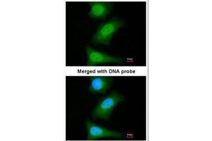 ICC/IF Image Immunofluorescence analysis of paraformaldehyde-fixed HeLa, using ML-IAP, antibody at 1:200 dilution.