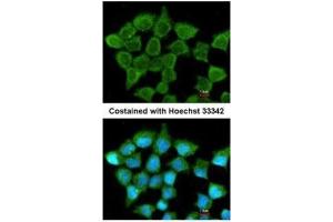 ICC/IF Image Immunofluorescence analysis of methanol-fixed A431, using SUCLA2, antibody at 1:200 dilution. (SUCLA2 anticorps)