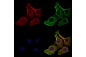 ABIN6262540 and ABIN6278895 staining Hela cells by IF/ICC. (IL17F anticorps  (Internal Region))