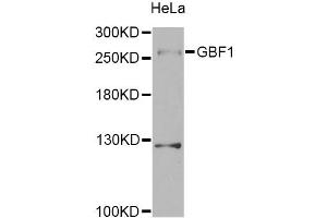 Western blot analysis of extracts of HeLa cells, using GBF1 Antibody. (GBF1 anticorps)