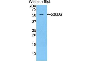Western Blotting (WB) image for anti-Transglutaminase 1, Keratinocyte (TGM1) (AA 504-737) antibody (ABIN1860737) (TGM1 anticorps  (AA 504-737))