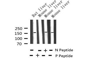 Western blot analysis of Phospho-EGFR (Thr678) expression in various lysates (EGFR anticorps  (pThr678))