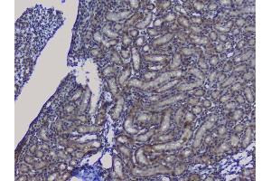 IHC analysis of NRF1 using anti-NRF1 antibody (ABIN6719347).