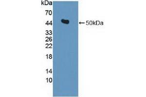 Detection of Recombinant IDH2, Human using Polyclonal Antibody to Isocitrate Dehydrogenase 2, mitochondrial (IDH2) (IDH2 anticorps  (AA 40-452))