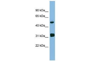LYAR antibody used at 1 ug/ml to detect target protein. (LYAR anticorps)