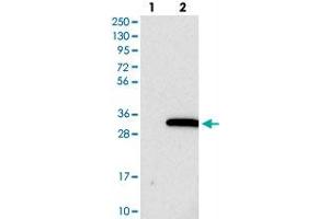 Western blot analysis of Lane 1: Negative control (vector only transfected HEK293T lysate), Lane 2: Over-expression Lysate (Co-expressed with a C-terminal myc-DDK tag (~3. (PIGX anticorps)