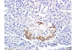 Formalin-fixed and paraffin embedded rat pancreas labeled with Anti-SREBP-1 Polyclonal Antibody, Unconjugated (ABIN686032) followed by conjugation to the secondary antibody and DAB staining (Srebp-1/2 (AA 301-450) anticorps)