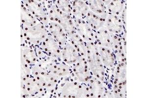 Immunohistochemistry analysis of paraffin-embedded mouse kidney using ADRA1B (ABIN7072974) at dilution of 1: 1200 (ADRA1B anticorps)