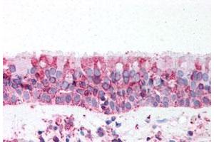 Immunohistochemistry (Formalin/PFA-fixed paraffin-embedded sections) of human trachea tissue with TRPV4 polyclonal antibody . (TRPV4 anticorps  (N-Term))