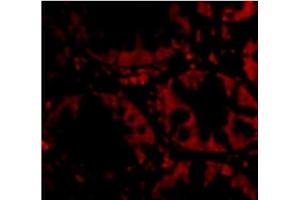 Immunofluorescence of STEAP2 in Human Colon cells with STEAP2 Antibody  at 20 µg/ml.