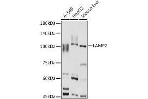 Western blot analysis of extracts of various cell lines, using L antibody (ABIN6129969, ABIN6143081, ABIN6143082 and ABIN6218224) at 1:1000 dilution. (LAMP2 anticorps  (AA 30-300))
