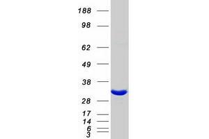 Validation with Western Blot
