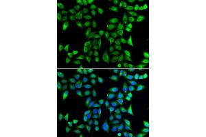 Immunofluorescence analysis of U20S cell using DNAJA3 antibody. (DNAJA3 anticorps)