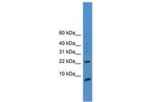 Image no. 1 for anti-Prostate Stem Cell Antigen (PSCA) (AA 51-100) antibody (ABIN6745361) (PSCA anticorps  (AA 51-100))