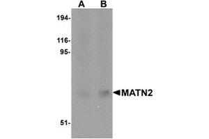 Western Blotting (WB) image for anti-Matrilin 2 (MATN2) (C-Term) antibody (ABIN1030508)