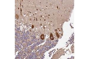 Immunohistochemical staining of human cerebellum with DDX27 polyclonal antibody  shows strong nucleolar and cytoplasmic positivity in Purkinje cells at 1:10-1:20 dilution.