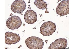 IHC analysis of Calmegin/CLGN using anti-Calmegin/CLGN antibody (ABIN7601481).