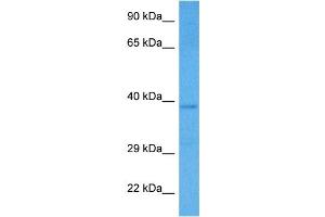 Host:  Rabbit  Target Name:  SMARCB1  Sample Tissue:  Human HCT15 Whole Cell lysates  Antibody Dilution:  1ug/ml (SMARCB1 anticorps  (Middle Region))