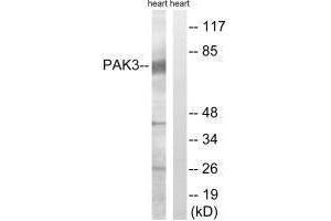 Western blot analysis of extracts from rat heart, using PAK3 (Ab-154) antibody.