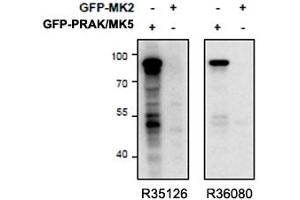 Western blot of HEK293 lysate overexpressing mouse MK5/PRAK (first lane) or mouse MK2 (second lane) tested with right ) PRAK antibody (cat # R36080, 0. (MAPKAP Kinase 5 anticorps)