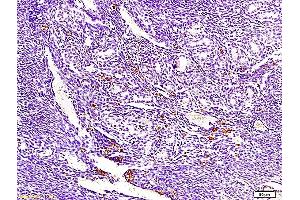 Formalin-fixed and paraffin embedded mouse endometrium tissue labeled with Anti-ECM1 Polyclonal Antibody, Unconjugated  at 1:300, followed by conjugation to the secondary antibody and DAB staining