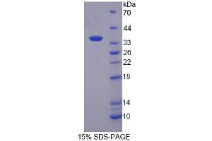 SDS-PAGE analysis of Human EEF1a2 Protein. (EEF1A2 Protéine)