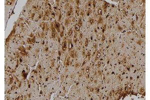 ABIN6275855 at 1/100 staining Human heart tissue by IHC-P. (STK33 anticorps  (N-Term))