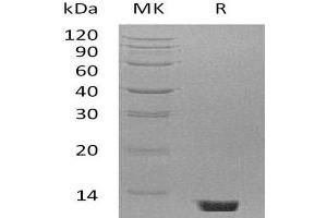 Western Blotting (WB) image for Complement Component 5 (C5) protein (ABIN7320495) (C5 Protéine)