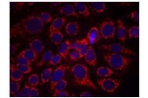 Immunofluorescence staining of methanol-fixed MCF7 cells using CD340 / ERBB2 / HER2 Antibody (pTyr1248) (ErbB2/Her2 anticorps  (pTyr1248))