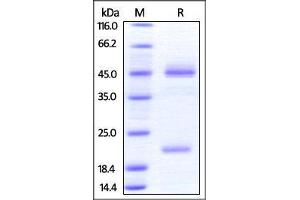 Human IL-23 alpha & Mouse IL-12 beta Heterodimer Protein on SDS-PAGE under reducing (R) condition. (IL12A & IL27B (AA 20-189) (Active) protein (His tag))