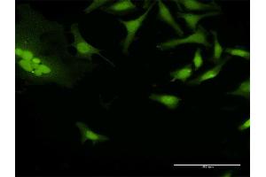 Immunofluorescence of purified MaxPab antibody to BAT3 on HeLa cell. (BAT3 anticorps  (AA 1-1126))