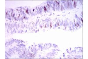 Immunohistochemistry (IHC) image for anti-Inner Centromere Protein Antigens 135/155kDa (INCENP) (AA 369-583) antibody (ABIN1844019)