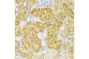 Immunohistochemistry of paraffin-embedded mouse kidney using CBS antibody at dilution of 1:100 (x400 lens).