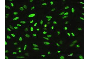 Immunofluorescence of purified MaxPab antibody to XRCC1 on HeLa cell.