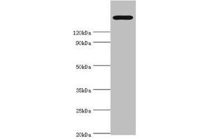 Western blot All lanes: TRPM2 antibody at 2 μg/mL + K562 whole cell lysate Secondary Goat polyclonal to rabbit IgG at 1/10000 dilution Predicted band size: 172, 166, 96 kDa Observed band size: 172 kDa
