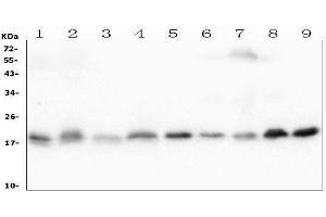 Western blot analysis of Cofilin-2 using anti-Cofilin-2 antibody (ABIN7602747).