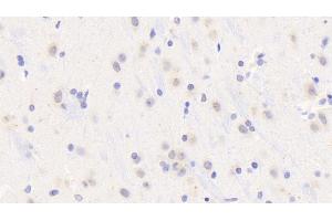 Detection of MyD88 in Rat Cerebrum Tissue using Polyclonal Antibody to Myeloid Differentiation Factor 88 (MyD88)