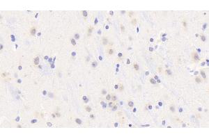 Detection of MyD88 in Rat Cerebrum Tissue using Polyclonal Antibody to Myeloid Differentiation Factor 88 (MyD88) (MYD88 anticorps  (AA 1-296))
