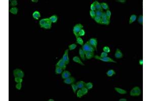 Immunofluorescence staining of PC-3 cells with ABIN7146892 at 1:133, counter-stained with DAPI. (CSNK2A2 anticorps  (AA 8-350))