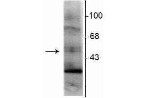 Western blot of rat hippocampal lysate showing specific immunolabeling of the ~48 kDa RXR-γ isotype. (Retinoid X Receptor gamma anticorps)