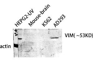 Western Blot (WB) analysis of HepG2-UV Mouse Brain AD293 K562 cells using VIM Polyclonal Antibody. (Vimentin anticorps  (C-Term))