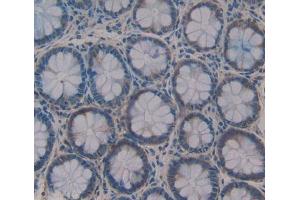 #VALUE! (SFTA2 anticorps  (AA 20-78))