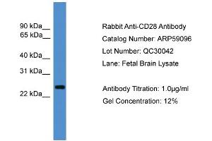 WB Suggested Anti-CD28  Antibody Titration: 0. (CD28 anticorps  (C-Term))