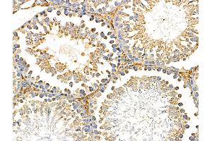 ABIN6259310 and ABIN6274936 at 1/100 staining Rat testis tissue by IHC-P. (PNPLA8 anticorps  (C-Term))