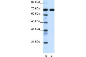 Human Jurkat; WB Suggested Anti-RRN3 Antibody Titration: 0. (RRN3 anticorps  (C-Term))